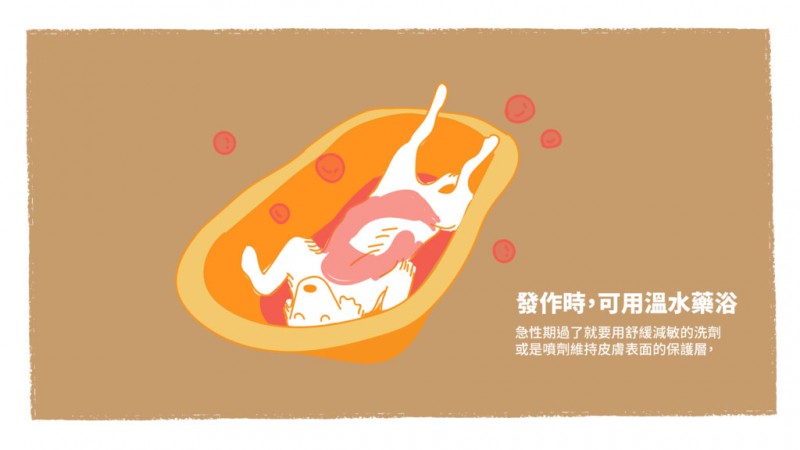癢癢發作可用溫水藥浴.jpg